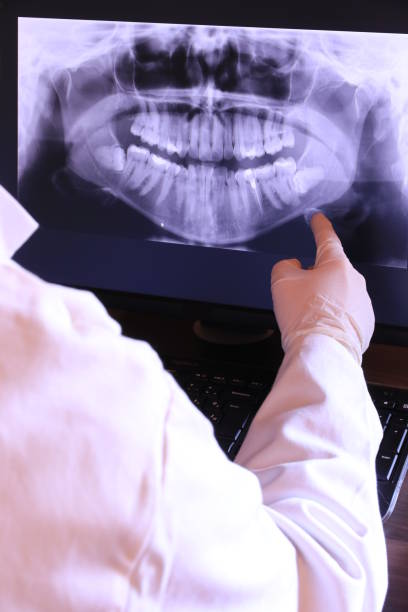 Best Emergency Treatment for Dental Infections or Abscesses in Moravian Falls, NC